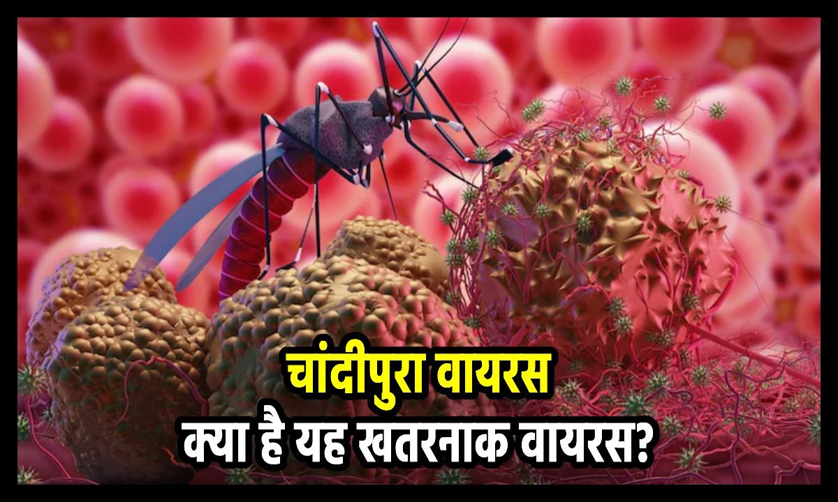 chandipura virus