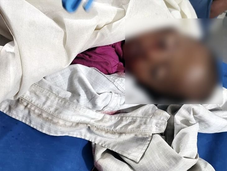 कोडरमा में बाइक गिराने से बच्चे की मौत: पार्टी टाइम एक्सीडेंट का हुआ शिकार, चेहरे पर आई गंभीर चोट - koderma News